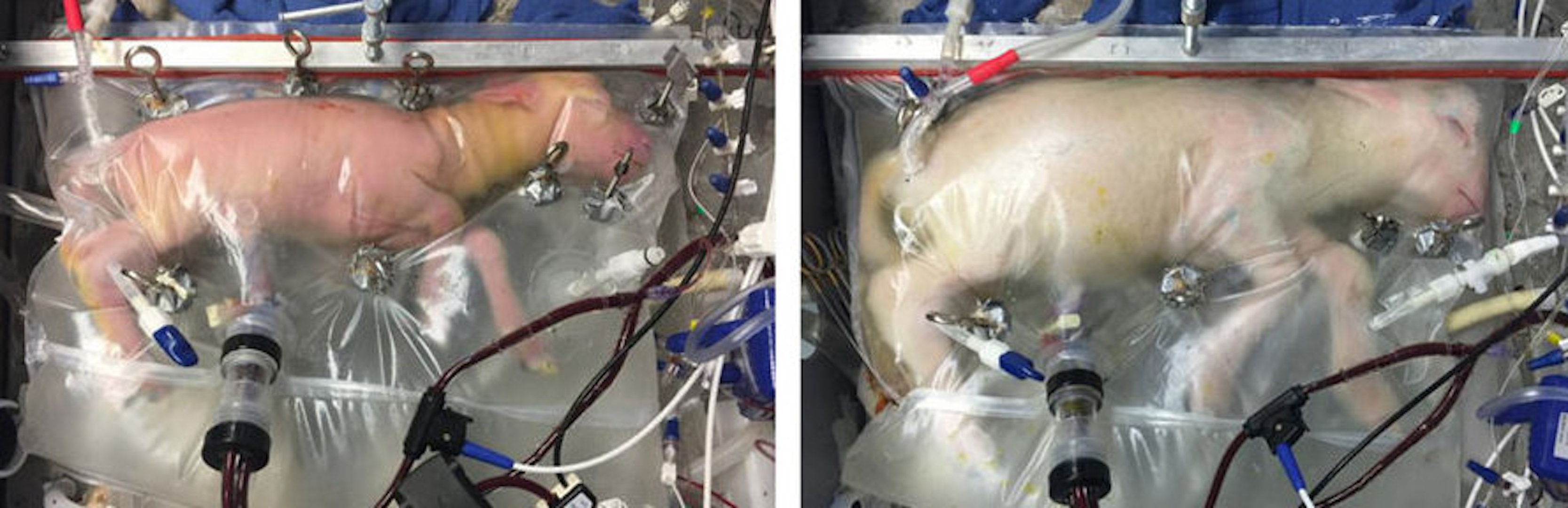 Artificial uterus for premature infants. Medicine and Science Artificial uterus for premature infants. Medicine and Science